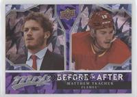 Matthew Tkachuk
